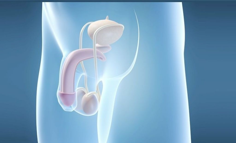 Prosthesis implantation is a surgical method to enlarge the male genital organ